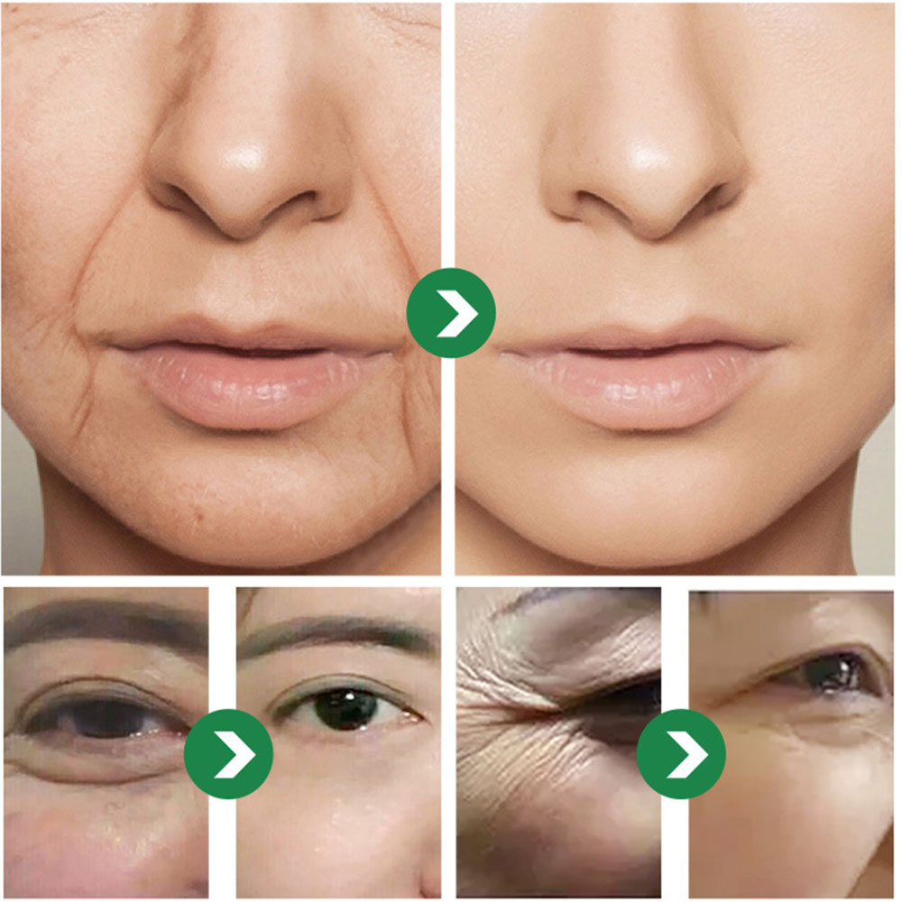 50g Japanese Six peptides Crea - Eye Cream Peptide recension och pris