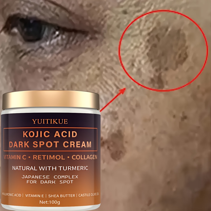 Arbutin fading cream, Vitamin  - Retinol Vitamin A Cream recension och pris